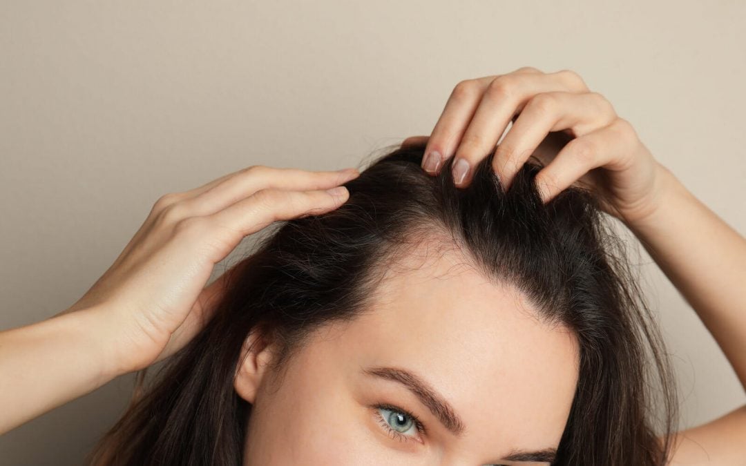 Itchy Scalp And Hair Loss: Could There Be A Connection?